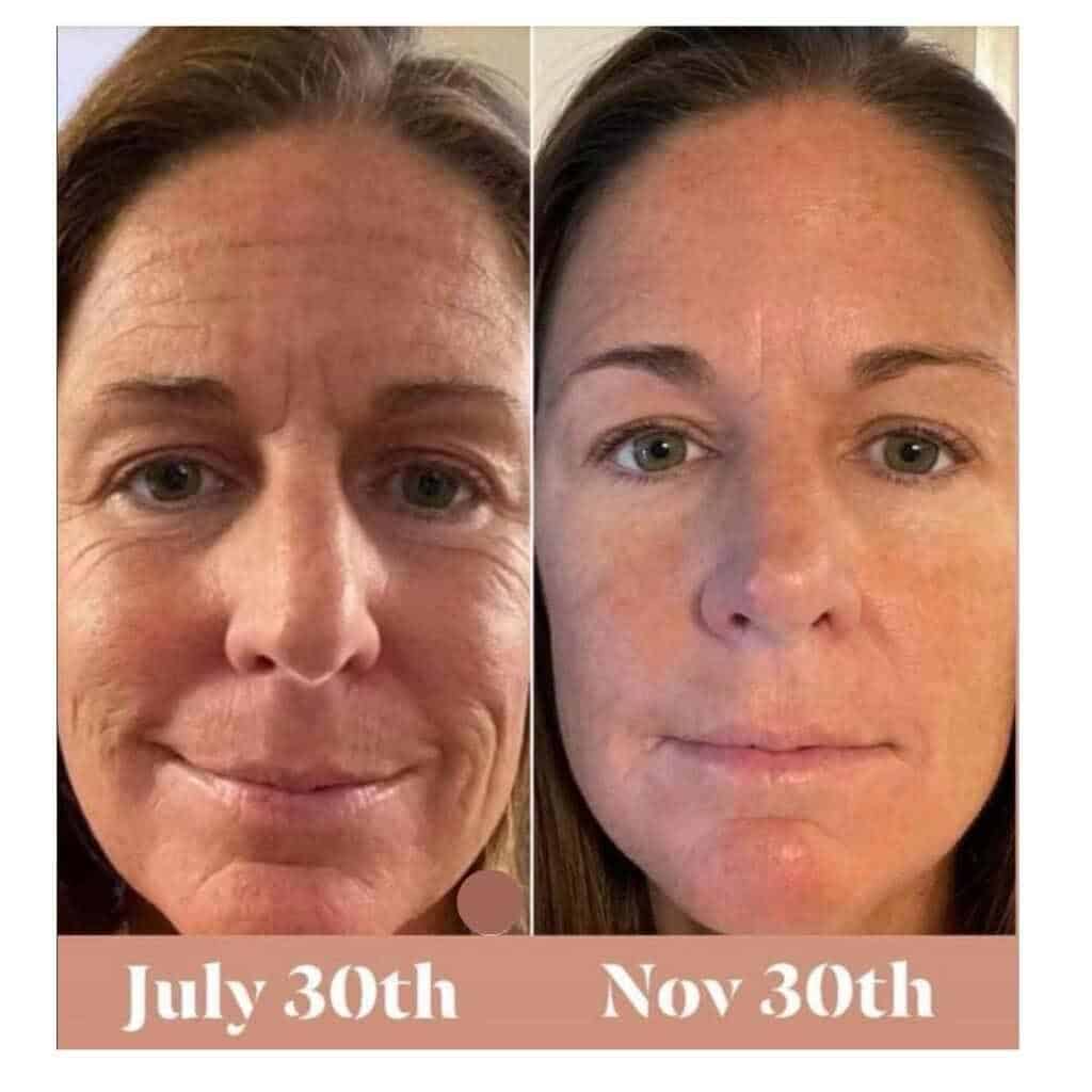 liquid collagen before and after skin results hydration and fine lines