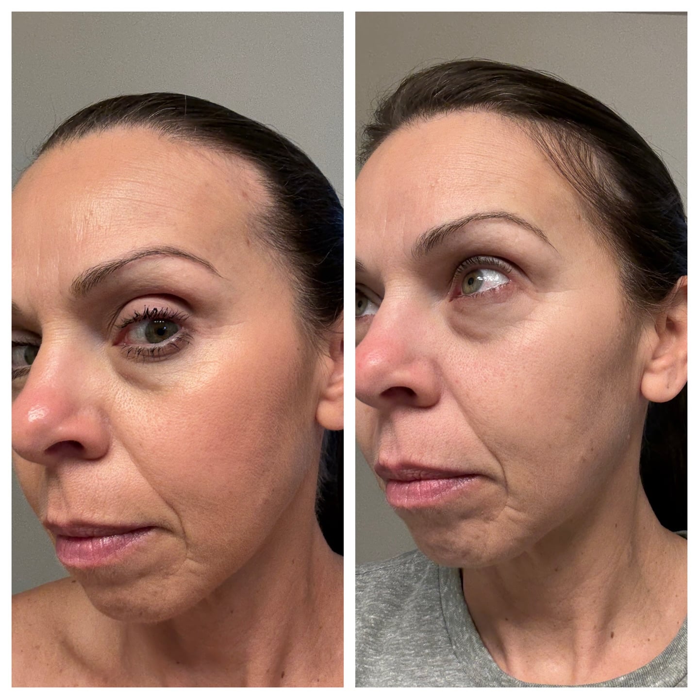 collagen benefits for hair growth and stronger nails